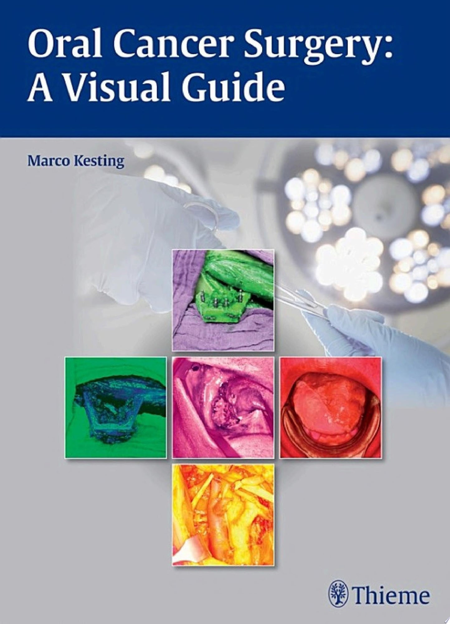 Oral Cancer Surgery: A Visual Guide: A Visual Guide