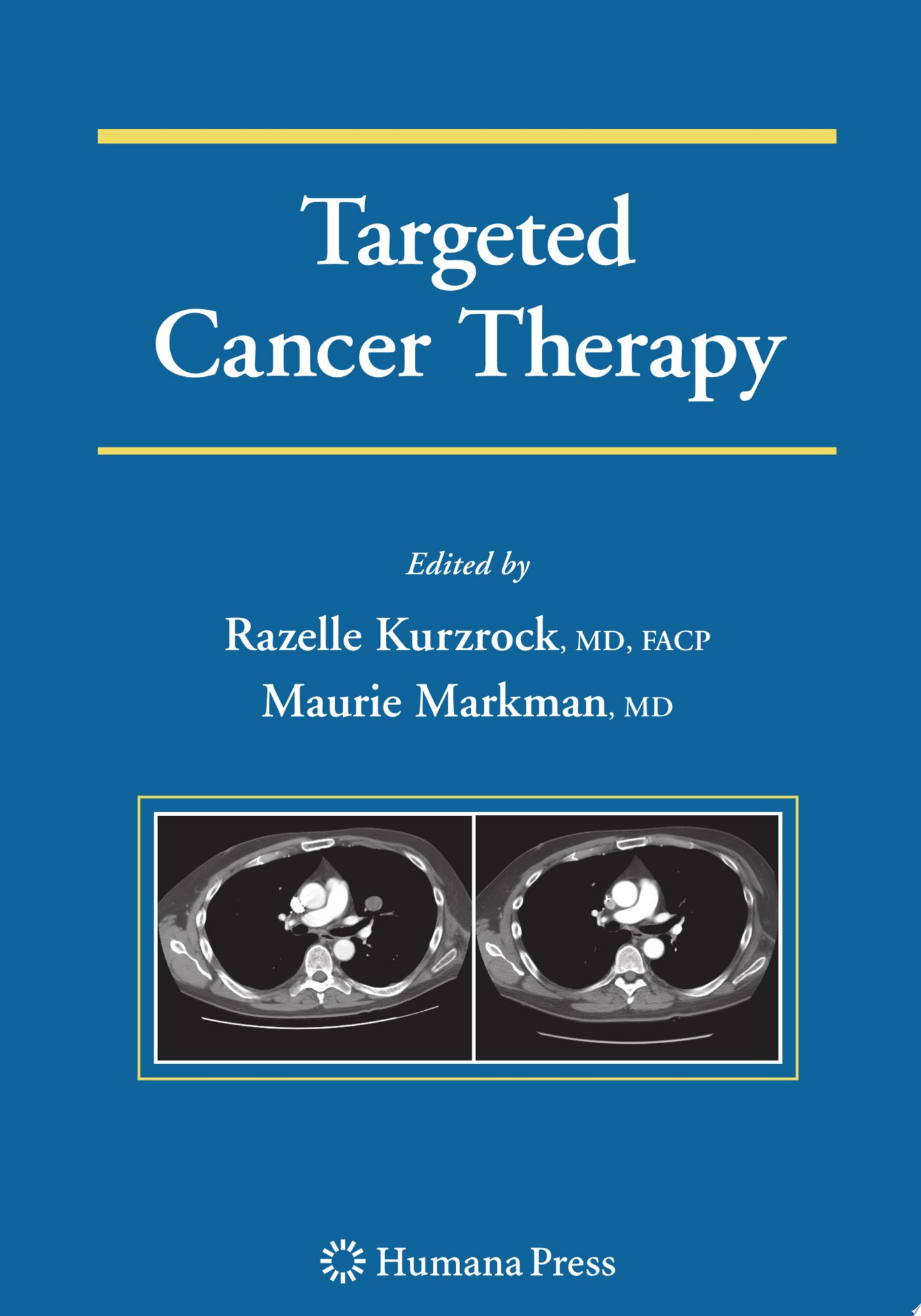 Targeted Therapies in Breast Cancer