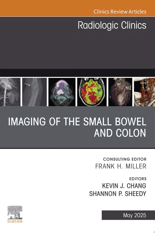 AJCC Cancer Staging System: Anus: Version 9 of the AJCC Cancer Staging System