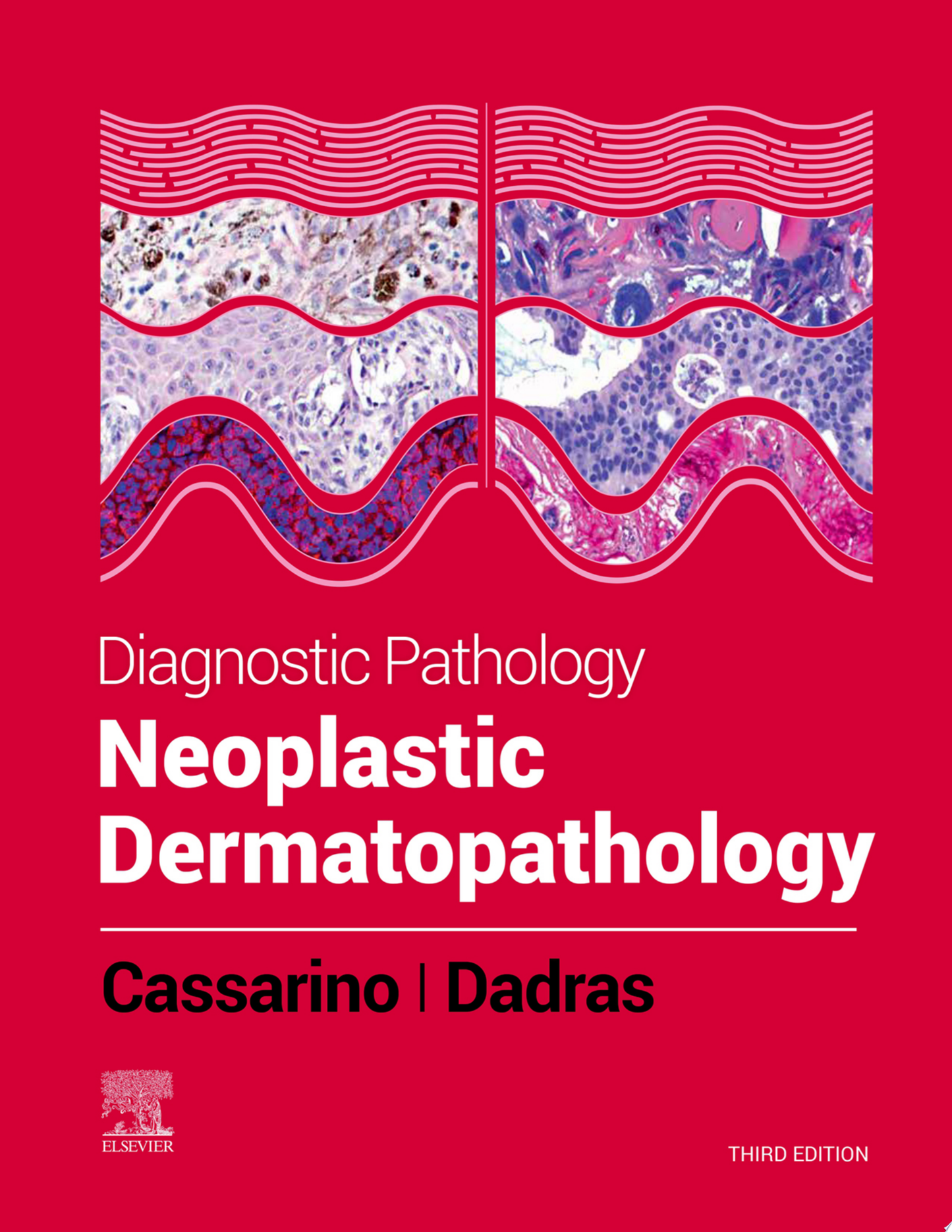Diagnostic Pathology: Neoplastic Dermatopathology, 3rd Edition