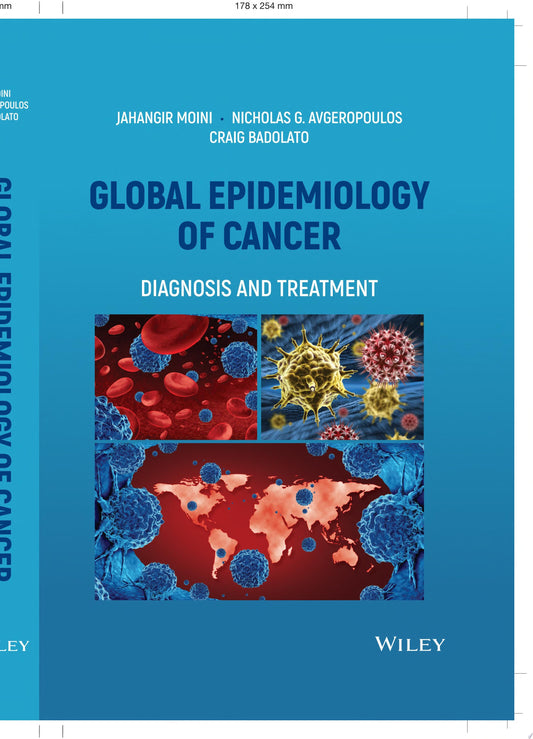 Global Epidemiology of Cancer: Diagnosis and Treatment