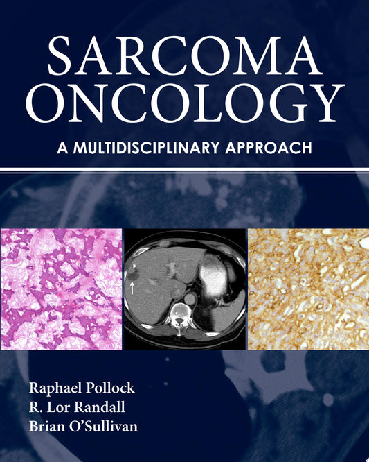 Sarcoma Oncology: A Multidisciplinary Approach