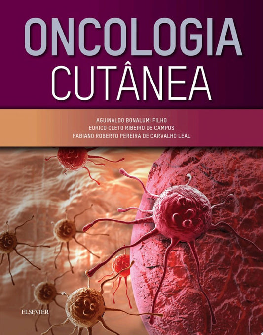 Oncologia Cutânea