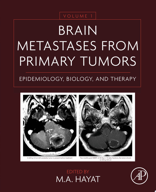 Brain Metastases from Primary Tumors, Volume 1: Epidemiology, Biology, and Therapy