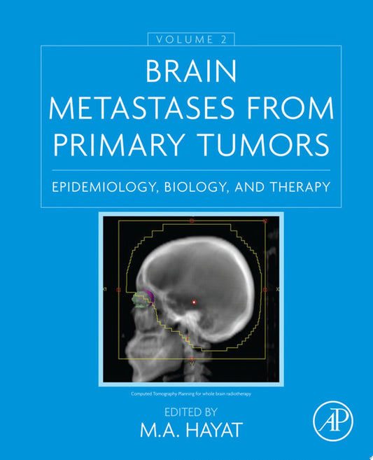 Brain Metastases from Primary Tumors, Volume 2: Epidemiology, Biology, and Therapy