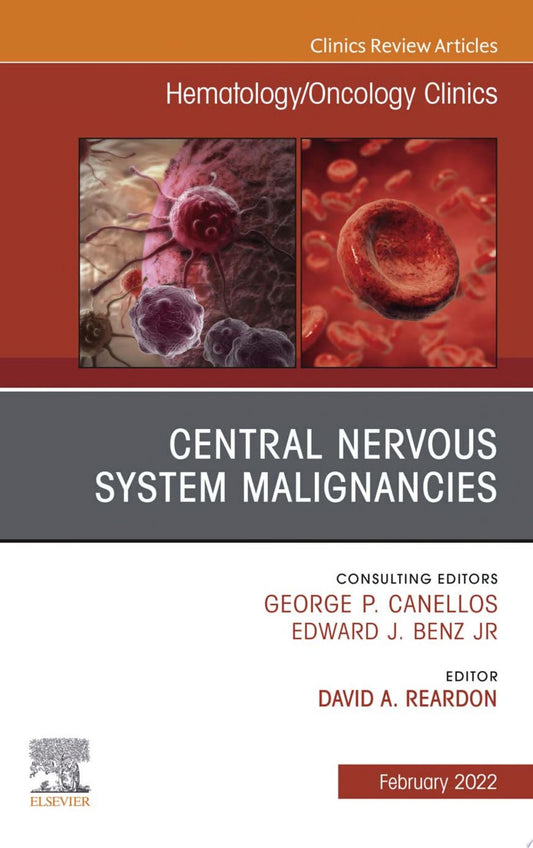 Central Nervous System Malignancies, An Issue of Hematology/Oncology Clinics of North America