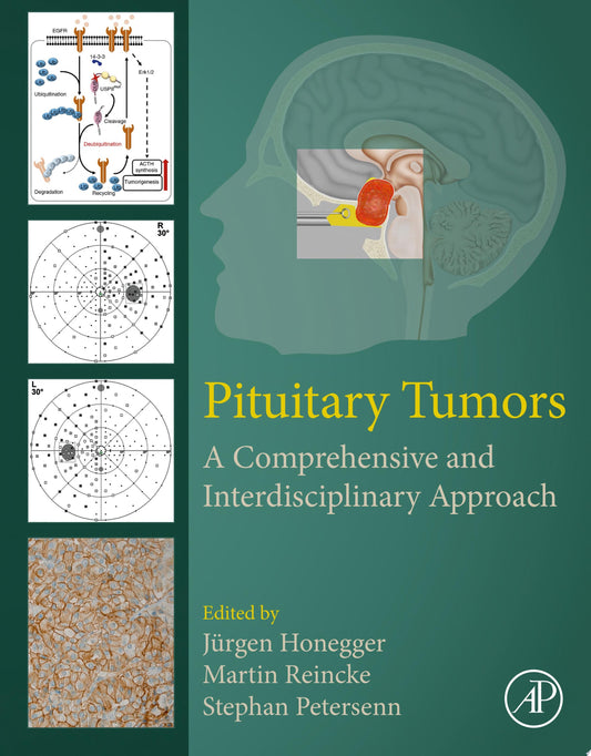 Pituitary Tumors: A Comprehensive and Interdisciplinary Approach