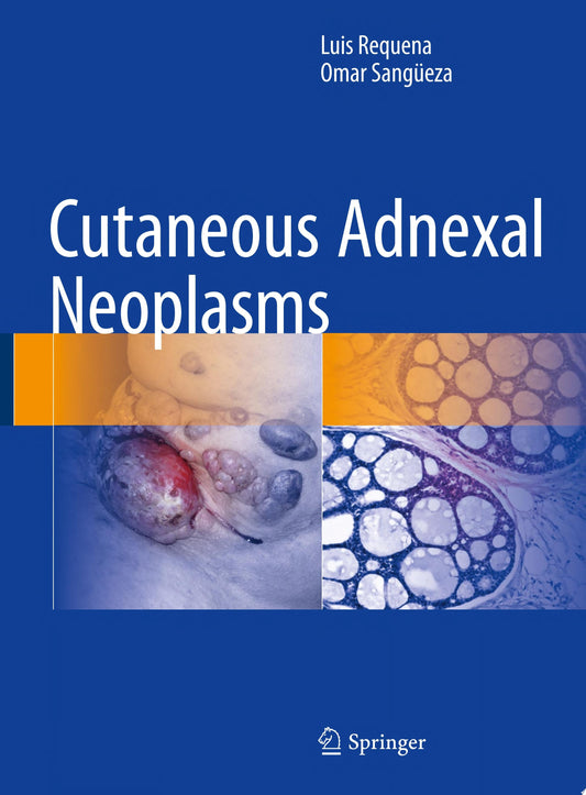 Cutaneous Adnexal Tumors
