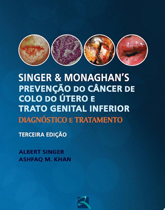 Singer e Monaghan’s Prevenção do Câncer de Colo do Útero e Trato Genital Inferior: Diagnóstico e Tratamento, 3rd Edition