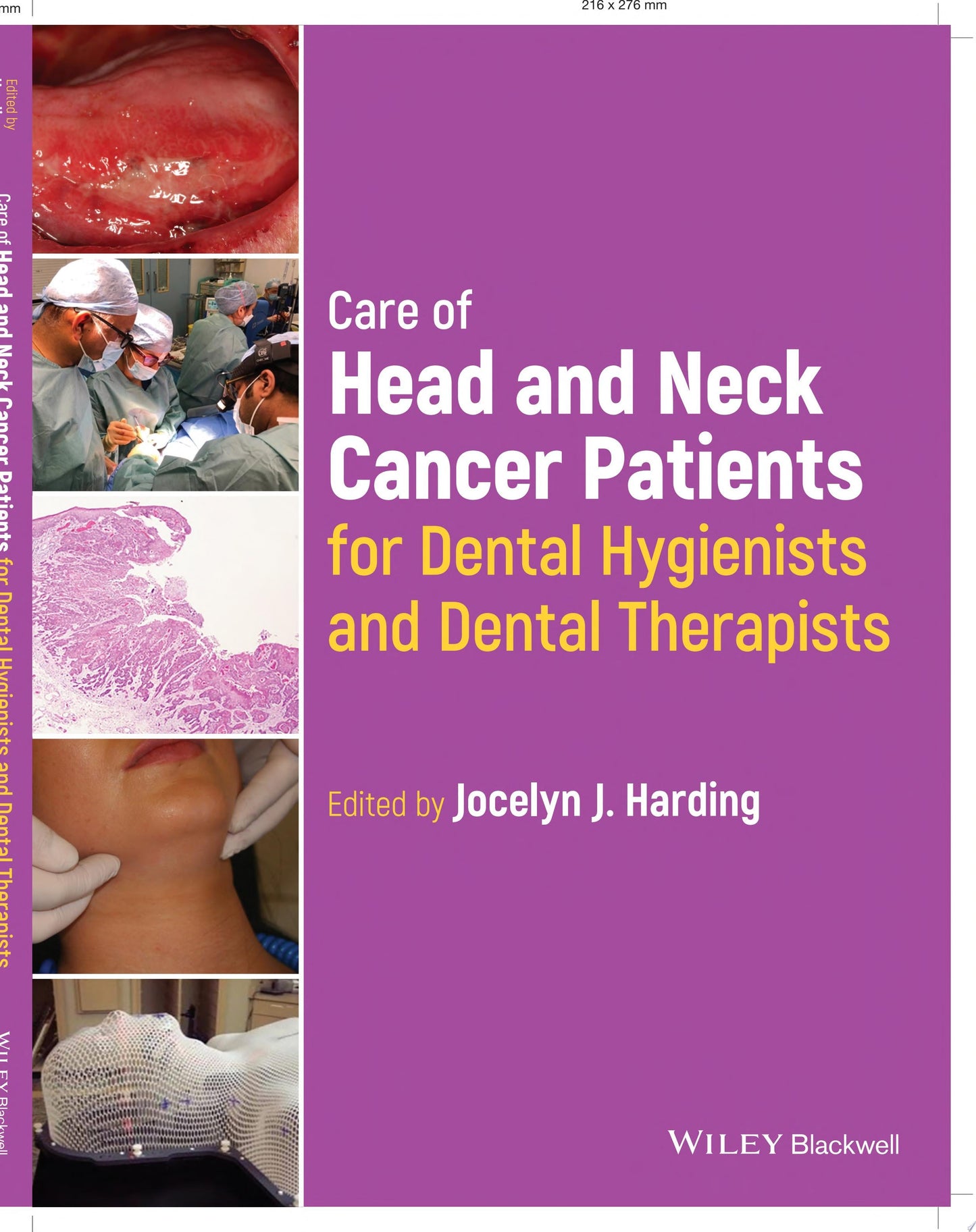 Care of Head and Neck Cancer Patients for Dental Hygienists and Dental Therapists